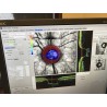 Optos OCT SLO Retina Glaucoma Cornea Analysis
