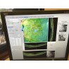 Optos OCT SLO Retina Glaucoma Cornea Analysis