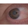 Volk Pictor Portable Retinal Camera