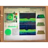 CARL ZEISS Cirrus HD-OCT 5000