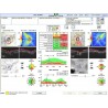 CARL ZEISS Cirrus HD-OCT 5000