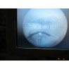 KOWA VX-10 Fundus Camera Mydriatic