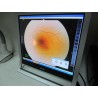 KOWA VX-10 Fundus Camera Mydriatic