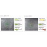 Centervue Maia Confocal Microperimetry
