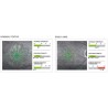 Centervue Maia Confocal Microperimetry