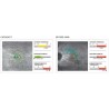 Centervue Maia Confocal Microperimetry