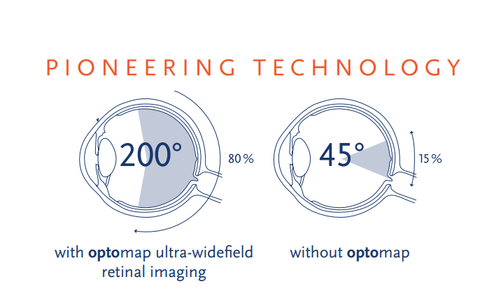 Optomap